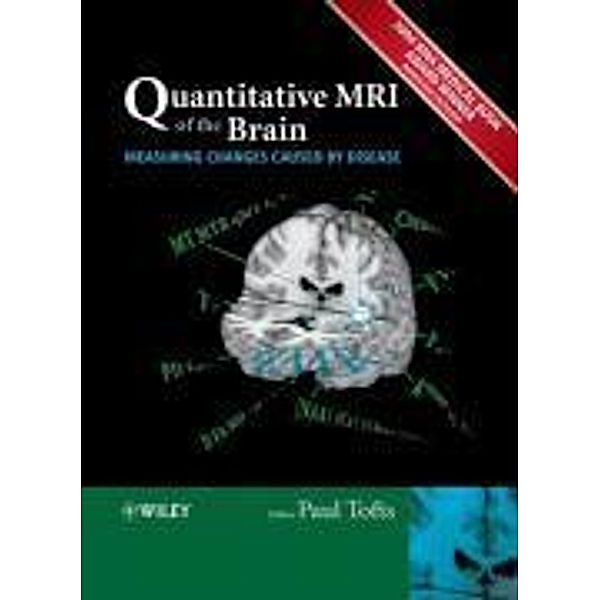 Quantitative MRI of the Brain