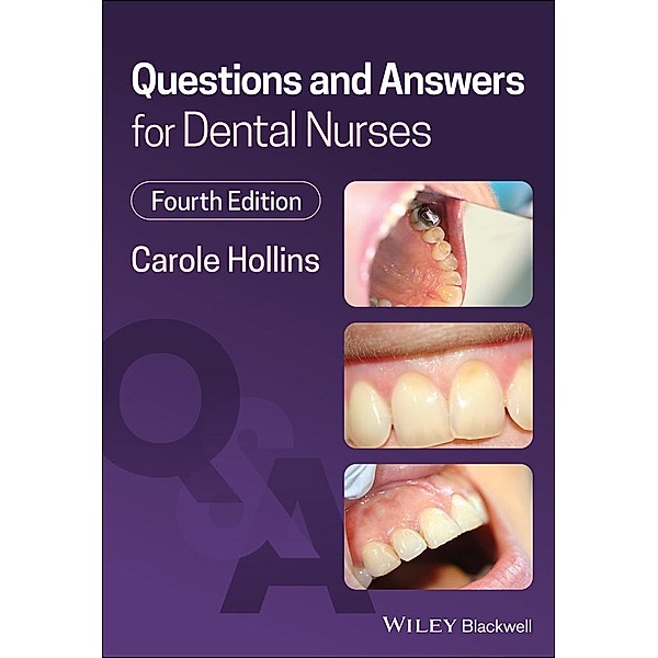 Questions and Answers for Dental Nurses, Carole Hollins
