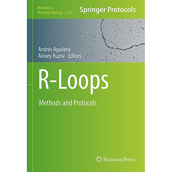 R-Loops