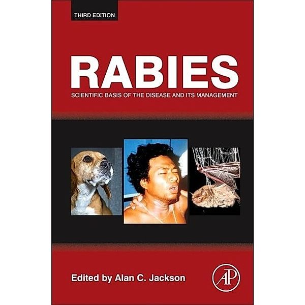 Rabies