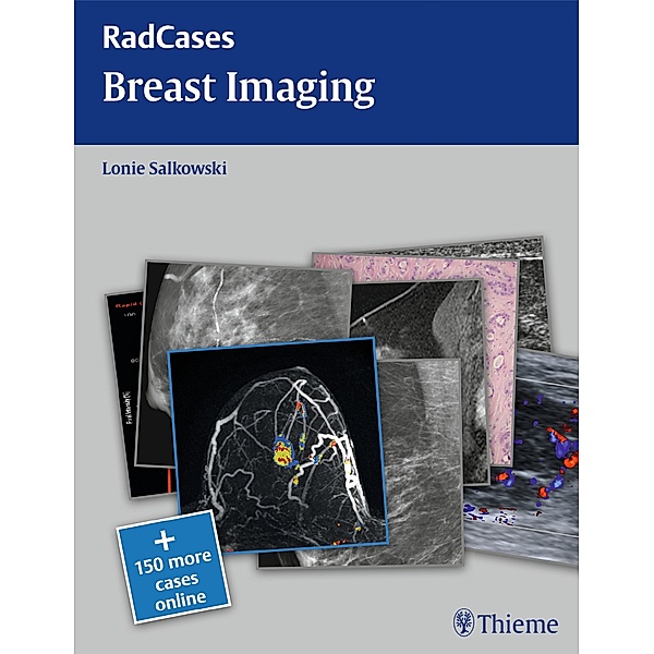 Radcases Breast Imaging / Radcases Plus Q&A, Lonie L. Salkowski