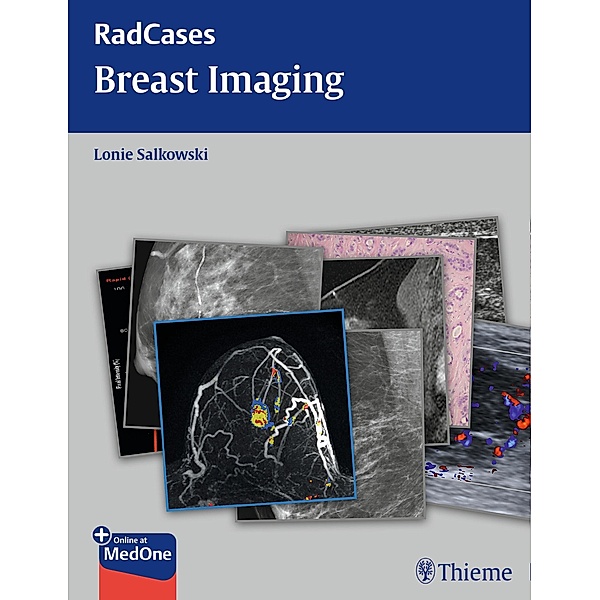 Radcases Breast Imaging / Radcases Plus Q&A, Lonie L. Salkowski