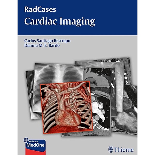 Radcases Cardiac Imaging / Radcases Plus Q&A, Carlos S Restrepo, Dianna M. E. Bardo