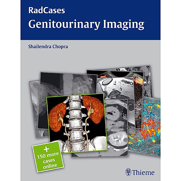 Radcases Genitourinary Imaging, Shailendra Chopra