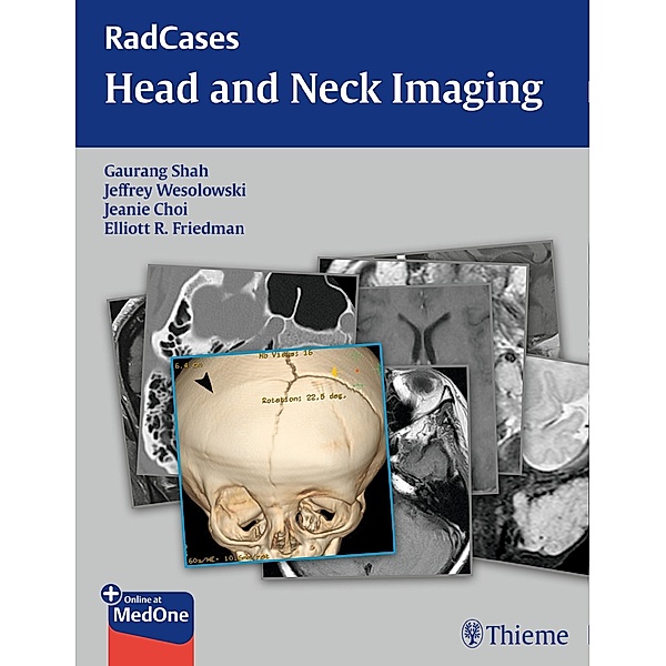 RadCases Head and Neck Imaging / Radcases Plus Q&A