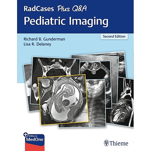 RadCases Plus Q&A Pediatric Imaging, Richard B. Gunderman, Lisa Delaney