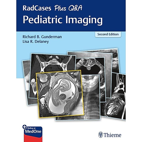 RadCases Plus Q&A Pediatric Imaging / Radcases Plus Q&A, Richard B. Gunderman, Lisa R. Delaney