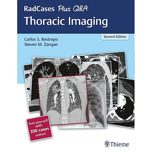 RadCases Plus Q&A Thoracic Imaging / Radcases Plus Q&A