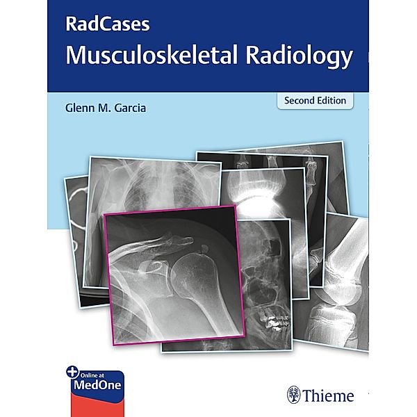 RadCases Q&A Musculoskeletal Radiology / Radcases Plus Q&A