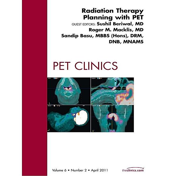 Radiation Therapy Planning, An Issue of PET Clinics, Sushil Beriwal