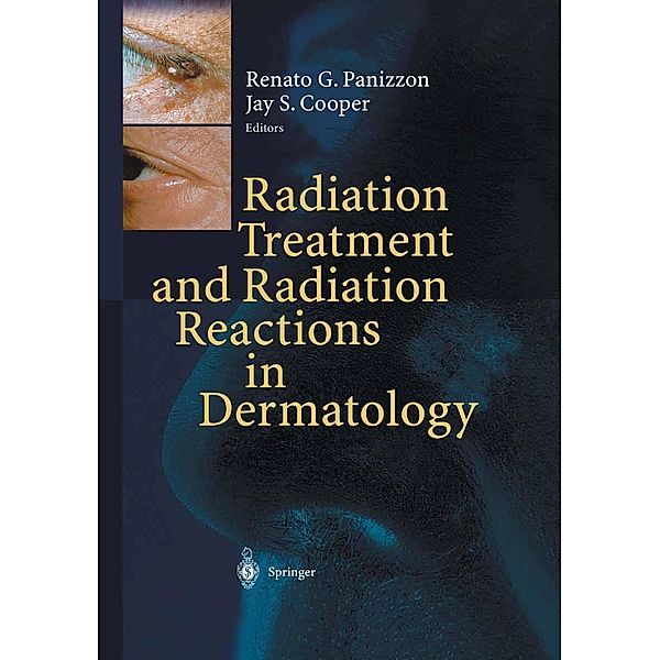 Radiation Treatment and Radiation Reactions in Dermatology