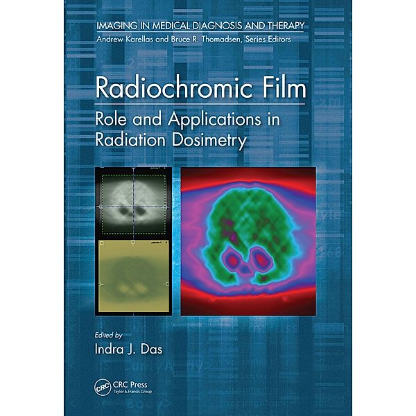 Radiochromic Film