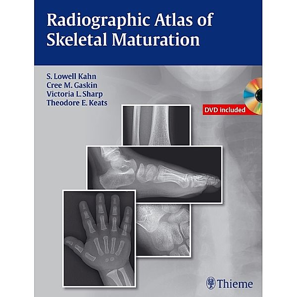 Radiographic Atlas of Skeletal Maturation, S. Lowell Kahn, Christopher M. Gaskin, Victoria L. Sharp, Theodore E. Keats, Bing Li