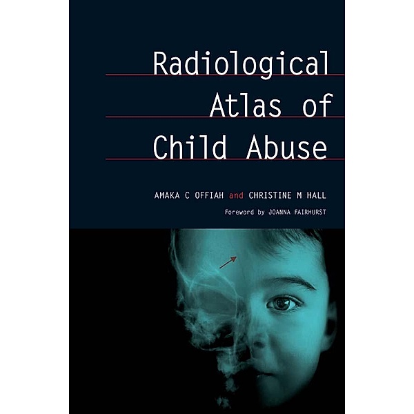 Radiological Atlas of Child Abuse, Amaka Offiah, Christine Hall