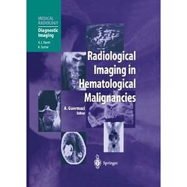 Radiological Imaging in Hematological Malignancies / Medical Radiology