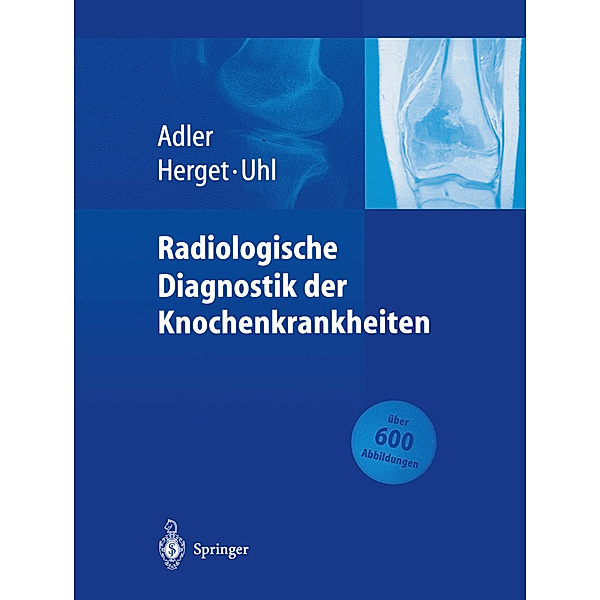 Radiologische Diagnostik der Knochenkrankheiten, Claus-Peter Adler, Georg Herget, Markus Uhl