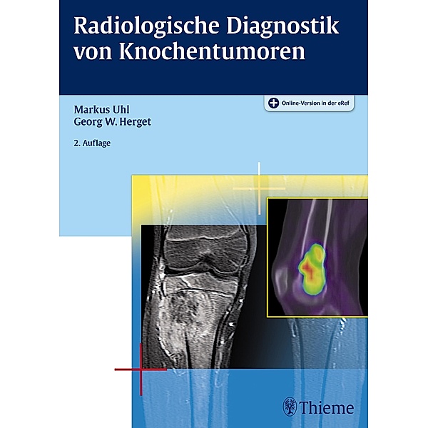 Radiologische Diagnostik von Knochentumoren