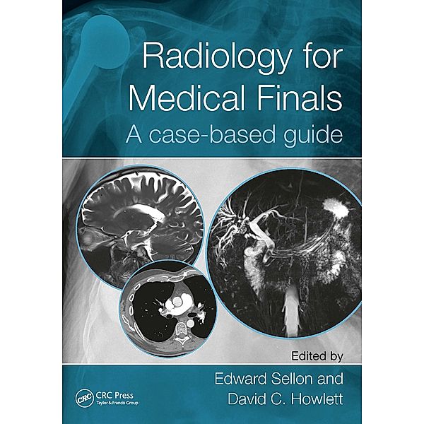 Radiology for Medical Finals