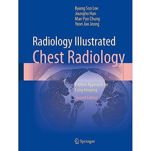 Radiology Illustrated: Chest Radiology / Radiology Illustrated, Kyung Soo Lee, Joungho Han, Man Pyo Chung, Yeon Joo Jeong