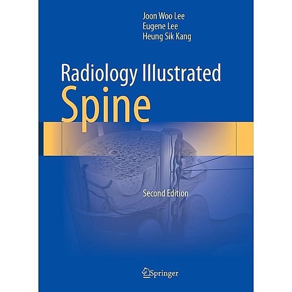 Radiology Illustrated: Spine / Radiology Illustrated, Joon Woo Lee, Eugene Lee, Heung Sik Kang