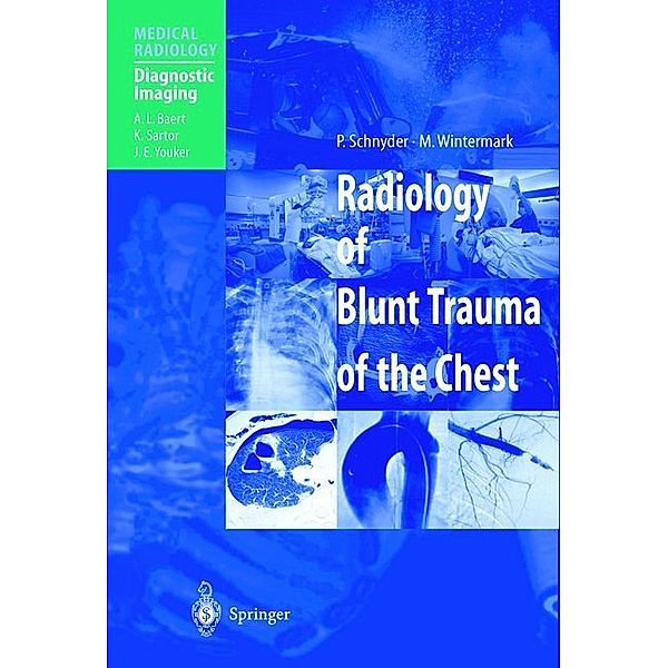 Radiology of Blunt Trauma of the Chest, P. Schnyder, M. Wintermark