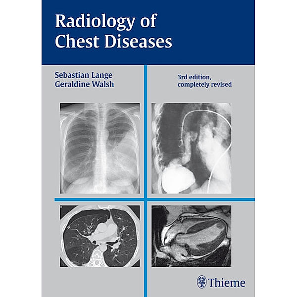 Radiology of Chest Diseases, Sebastian Lange, Geraldine Walsh