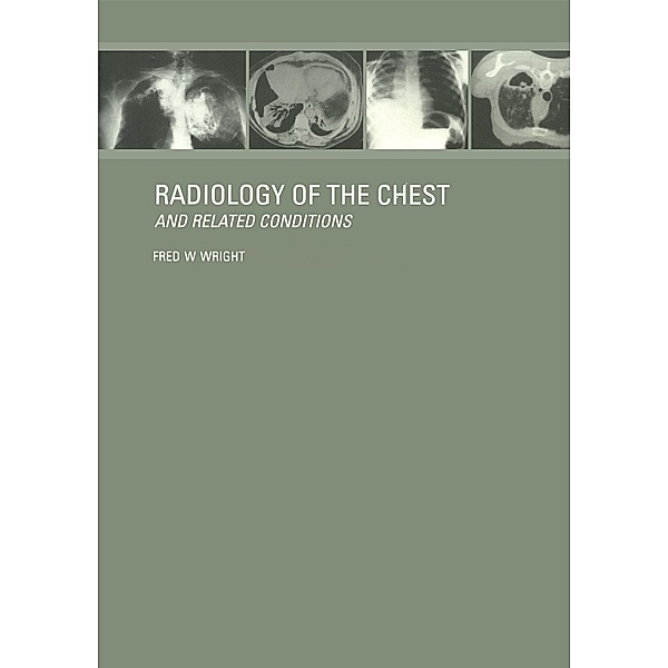 Radiology of the Chest and Related Conditions, F W Wright