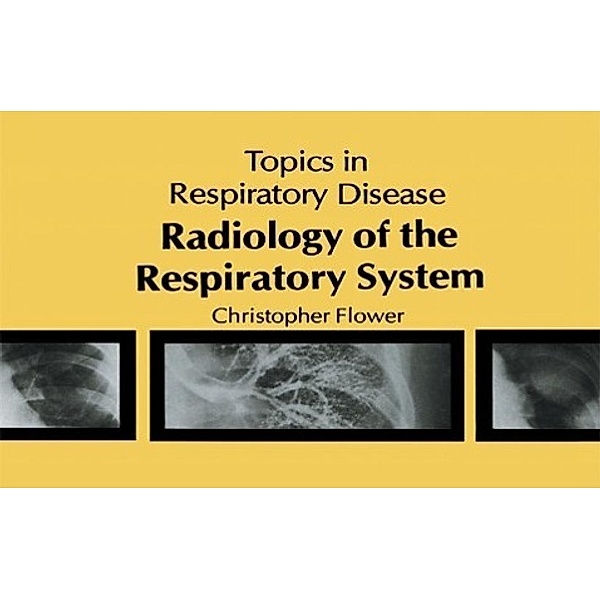 Radiology of the Respiratory System, C. D. R Flower