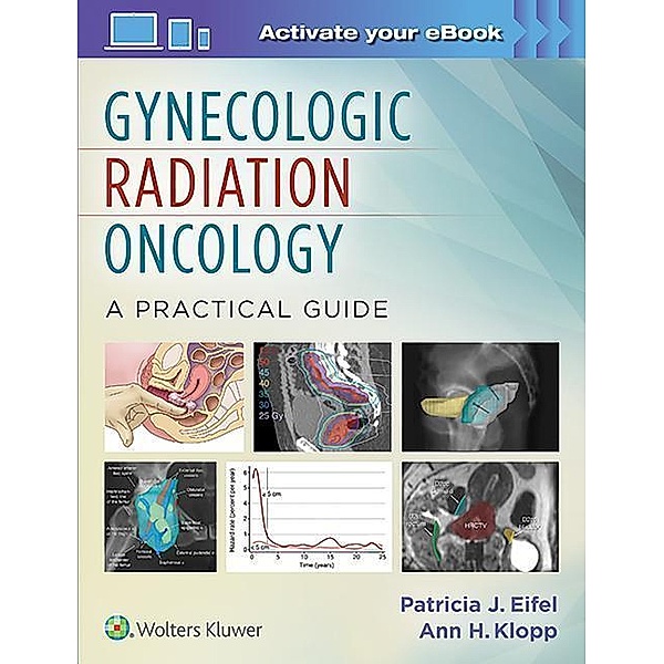 Radiotherapy for Gynecologic Cancers: A Practical Guide, Patricia Eifel