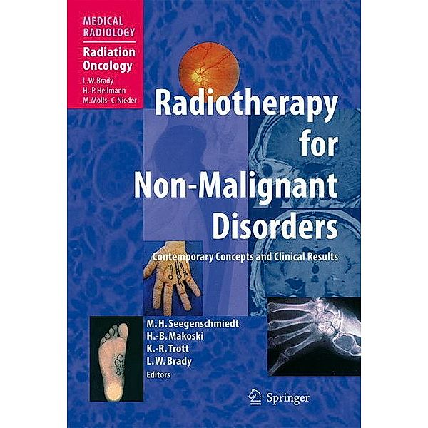 Radiotherapy for Non-Malignant Disorders