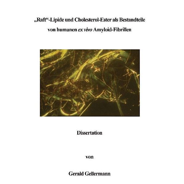 Raft -Lipide und Cholesterol-Ester als Bestandteile von humanen ex vivo Amyloid-Fibrillen