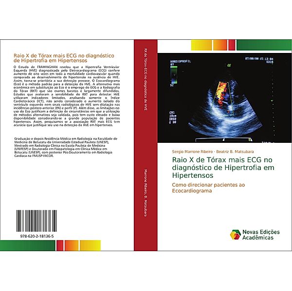 Raio X de Tórax mais ECG no diagnóstico de Hipertrofia em Hipertensos, Sergio Marrone Ribeiro, Beatriz B. Matsubara