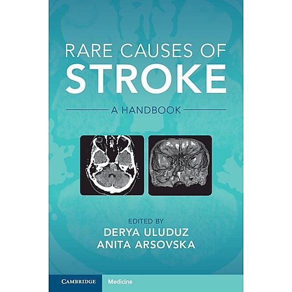 Rare Causes of Stroke