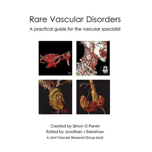 Rare Vascular Disorders, Simon Parvin