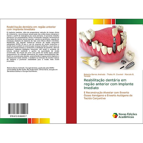 Reabilitação dentária em região anterior com Implante Imediato, Roberta Barros Andrade, Thales M. Cruvinel, Marcelo B. Toniollo
