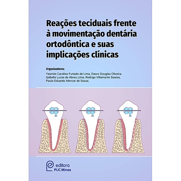 Reações teciduais frente à movimentação dentária ortodóntica e suas implicações clínicas