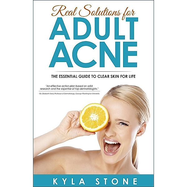 Real Solutions for Adult Acne, Kyla Stone