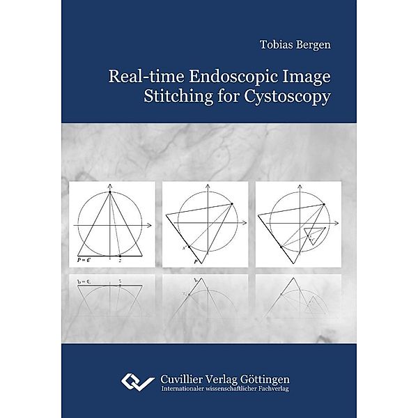 Real-time Endoscopic Image Stitching for Cystoscopy