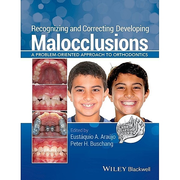 Recognizing and Correcting Developing Malocclusions