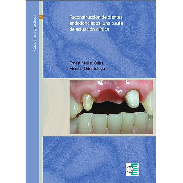Reconstrucción de dientes endodonciados, Ernest Mallat Callís
