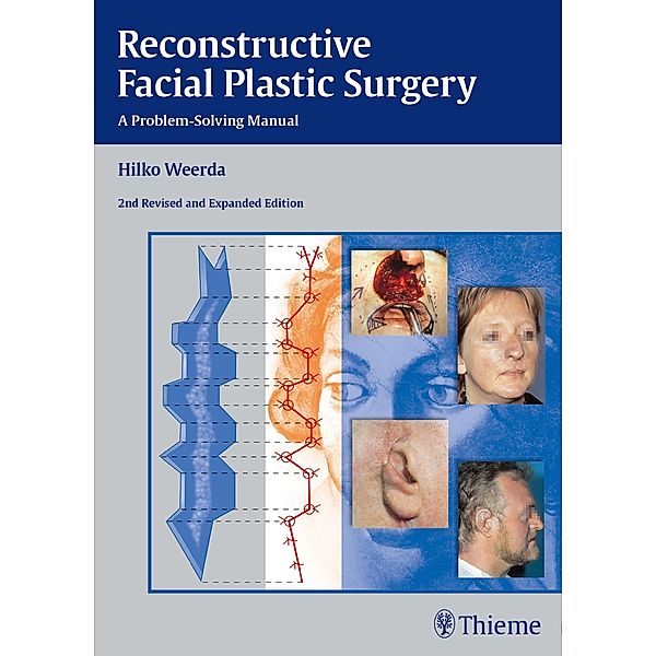 Reconstructive Facial Plastic Surgery, Hilko Weerda