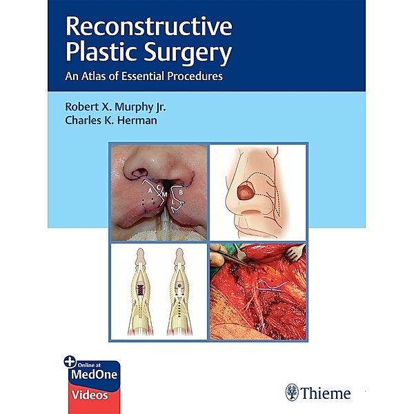 Reconstructive Plastic Surgery, Robert Murphy, Charles Herman