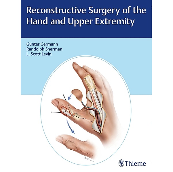 Reconstructive Surgery of the Hand and Upper Extremity, Günter Germann, L. Scott Levin, Randolph Sherman