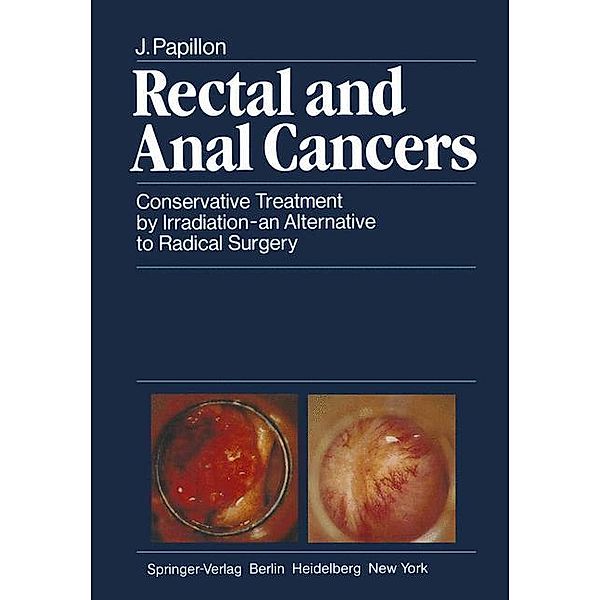 Rectal and Anal Cancers, J. Papillon