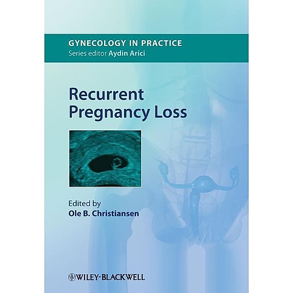 Recurrent Pregnancy Loss