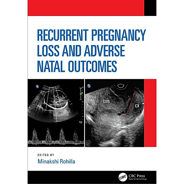 Recurrent Pregnancy Loss and Adverse Natal Outcomes