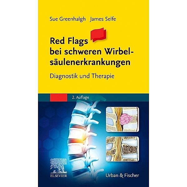 Red Flags - Schwerpunkt Wirbelsäule, Sue Greenhalgh, James Selfe