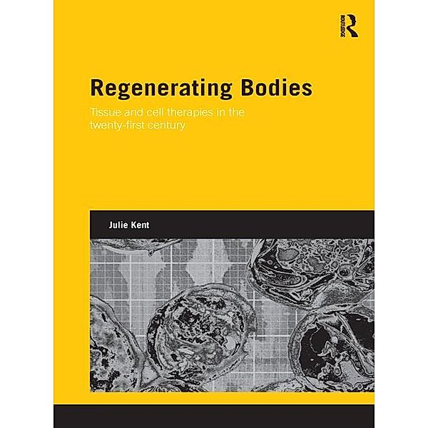 Regenerating Bodies, Julie Kent