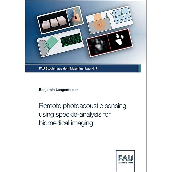 Remote photoacoustic sensing using speckle-analysis for biomedical imaging, Benjamin Lengenfelder