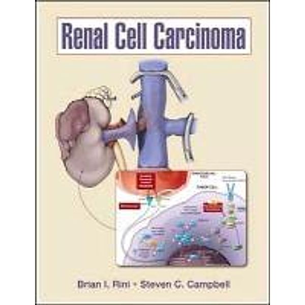 Renal Cell Carcinoma, Brian I. Rini, Steven C. Campbell